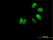 H00011200-B01P - CHK2