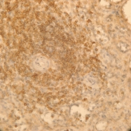 H00011214-M10 - AKAP13
