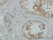 H00011216-M04 - AKAP10