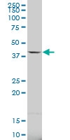 H00011238-A01 - Carbonic anhydrase 5B