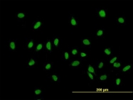 H00011244-B01 - ZHX1