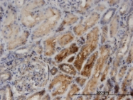 H00011252-M05 - PACSIN2