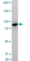 H00011253-M01 - MAN1B1