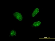 H00011258-B01P - Dynactin subunit 3