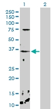 H00011261-D01P - Calcium-binding protein p22