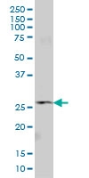 H00011267-M01 - Vacuolar-sorting protein SNF8