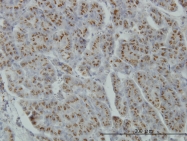 H00011320-M02 - MGAT4A
