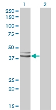H00011321-M01 - GPN1 / XAB1