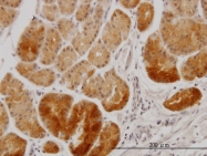 H00011321-M01 - GPN1 / XAB1