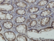 H00011329-M11 - STK38