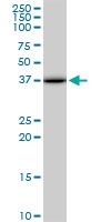 H00011332-M02 - ACOT7 / BACH