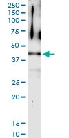 H00011344-D01 - Twinfilin-2 (TWF2)