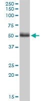 H00011344-M01 - Twinfilin-2 (TWF2)