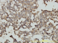 H00022800-M01 - RRAS2 / TC21