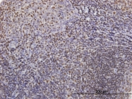 H00022806-B01P - ZNFN1A3 (IKZF3, Aiolos)