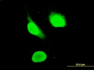 H00022806-M02 - ZNFN1A3 (IKZF3, Aiolos)