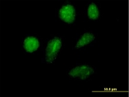 H00022807-B01P - ZNFN1A2 (IKZF2, Helios)