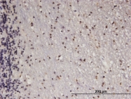 H00022809-M07 - ATF5
