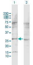 H00022859-D01P - Latrophilin-1 / AGRL1