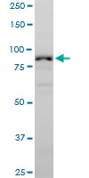 H00022871-A01 - Neuroligin 1