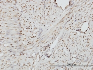 H00022882-M01 - ZHX2