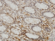 H00022928-M02 - SEPHS2