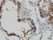 H00022932-M02 - POMZP3