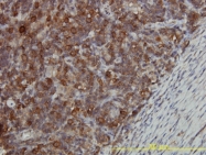 H00022948-M01 - CCT5 / TCP1 epsilon