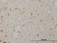 H00023049-M03 - SMG1