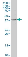 H00023219-A01 - FBXO28