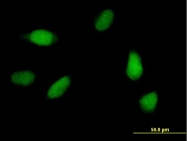 H00023244-B01 - SCC-112 / PDS5A