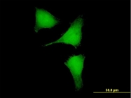 H00023248-B01 - RPRD2