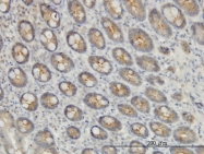 H00023265-M01 - EXOC7