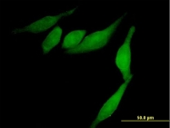 H00023287-B01 - AGTPBP1 / CCP1