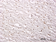 H00023411-M01 - SIRT1