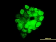 H00023421-M01 - CENP-R / ITGB3BP