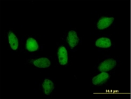 H00023468-D01P - CBX5