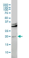 H00023468-M01 - CBX5