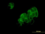 H00023549-M01 - Aspartyl aminopeptidase