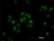 H00023594-B01P - ORC6