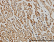 H00023597-M01 - ACOT9