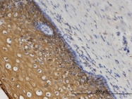 H00023603-M02 - Coronin-1C