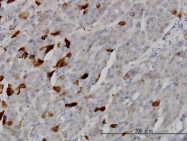 H00023617-M02 - TSSK2