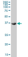 H00023617-M03 - TSSK2