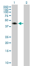 H00023632-B01P - Carbonic anhydrase 14