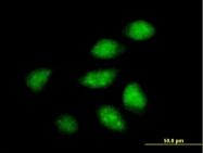 H00023647-B01 - Arfaptin-2