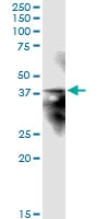 H00023673-D01 - Syntaxin 12 / STX12
