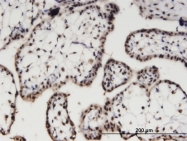 H00023746-M04 - AIPL1