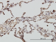 H00024139-M01 - EMAP2 / EML2