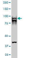 H00025788-M01 - RAD54B
